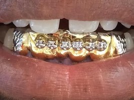 custom gold teeth grillz with 6 cz stone - $250.00