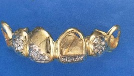 custom gold teeth grillz with 20 cz stone bottom or top - £235.68 GBP