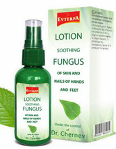 Anti-Fungal Lotion 50ml EVTERPA KILLS 99.9% of nail Fungus on feet, toes, hands - £4.49 GBP