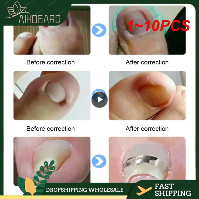 1~10PCS Ingrown Toenail Corrector Tools Pedicure Recover Embed Toe Nail - £10.22 GBP+