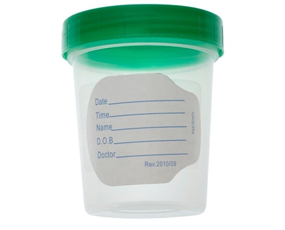 100 Urine Specimen Collection Cup 4 oz Sterile Sample Container Screw Ca... - $42.56
