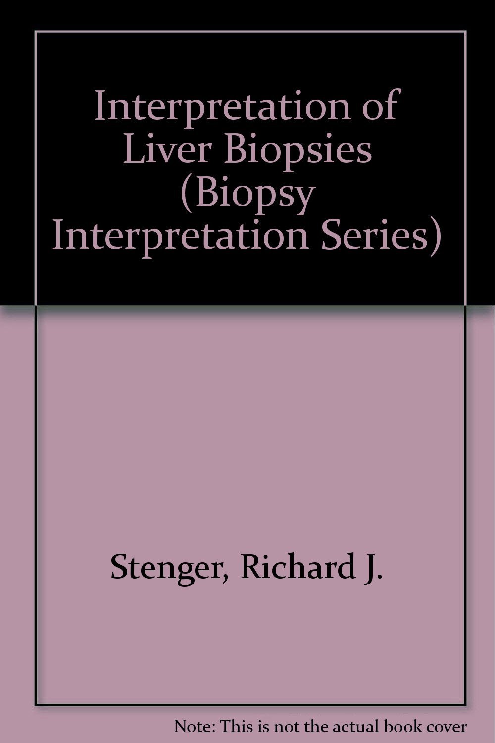 Interpretation of Liver Biopsies (Biopsy Interpretation Series) [Hardcov... - $2.47