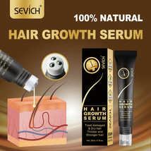Sevich Ginger Hair Growth Oil Fast Anti Hair Loss Treatment Natural Extr... - £10.23 GBP