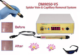 Laser spider capillary vein reduction removal kit for legs face nose &amp; body. - £791.17 GBP