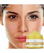 Tumeric Body Scrub, Acne, Dark Spots, Hyperpigmentation Smooth Skin exfo... - $18.98