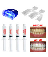 Complete Teeth Whitening Kit At Home System 44% Extreme Gel Syringe Made... - $15.70 CAD