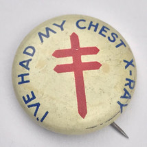 I’ve Had My Chest X-Ray Pin Button Pinback Vintage by Imber Chicago Small - £7.86 GBP