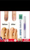 2 Pack Orivelle Anti Pen Swissclear Anti Fungal Pen Anti Fungal Nail NEW!!! - $11.69