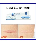 Erase Gel for Scar Remover Wound Care Keloid Acne Surgery Scars Remover ... - £23.58 GBP