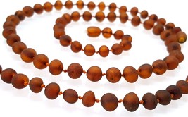 Natural Raw Unpolished Baltic Amber Necklace/ Round Baroque Beads  - £31.16 GBP