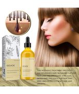Natural Hair Growth Organic Rosemary Oil for Dry Damaged Hair and Growth... - $275.44 MXN