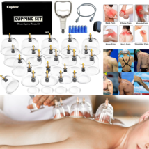 Ventosas De Acupuntura 24 Pcs Set Chinas Para Terapia Masajes Celulitis ... - $656.16 MXN