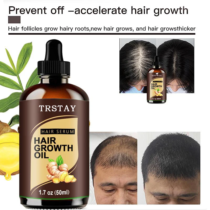 Sporting Powerful Hair Growth A Prevent Hair Loss Products Essence Liquid Treatm - $29.90