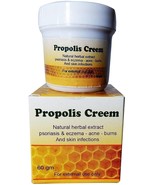 2 Pack Herbal Beeswax &amp; Aloe Vera Cream for Psoriasis, Eczema 60g Each - $875.09 MXN