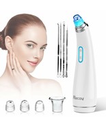 Blackhead Remover Vacuum - USB Rechargeable Blackhead Suction Device w/4... - $428.07 MXN