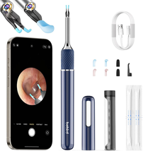 Ear Tweezers with Camera, Note5 Visual Ear Wax Removal Tool Camera with 10 Megap - £98.98 GBP