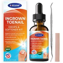 TOTCLEAR Ingrown Toenail Relief Drops Softener Kit - $10.00