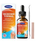 TOTCLEAR Ingrown Toenail Relief Drops Softener Kit - $13.74 CAD