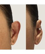 Protruding ear corrector EARCLIC - £39.33 GBP
