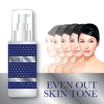 Fairtone Skin Fade Gel Stop Chloasma Age Spots Dark Sun Spots Evens Skin Tone - £27.00 GBP