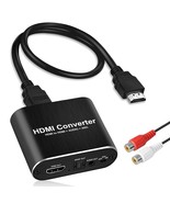 4K@60Hz Hdmi Audio Extractor, Hdmi To Hdmi + Optical Toslink Spdif + 3.5... - $47.99