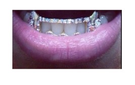 14k gold Overlay Removable gold teeth caps Grillz &amp; mold kit 6 teeth gri... - £83.62 GBP