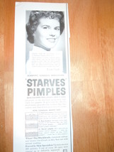 Vintage Clearasil Magazine Advertisement 1960 - $3.99