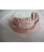 Vintage Cast Dental Teeth Mold  Tooth Castings Medical Oddity #3 - $282.72 MXN