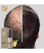 Fast Growth Hair Essence Oil Hair Loss Treatment Essential Spray for Hai... - £12.68 GBP+