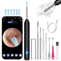 , Ear Wax Removal Tool with 1269P, Ear Camera Otoscope with Light, - £78.31 GBP