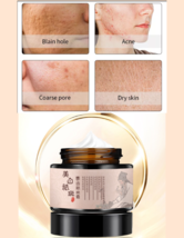 Crema blanqueadora para hombres y mujeres que elimina manchas oscuras ma... - $18.90 CAD