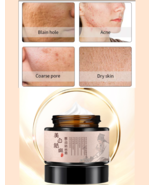 Crema blanqueadora para hombres y mujeres que elimina manchas oscuras ma... - $13.81