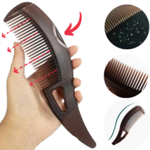 Anti-dandruff Hair Comb, Removes Dandruff &amp; Dirt From Scalp, Clean Healt... - £8.69 GBP