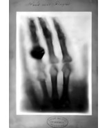 Radiograph of Hand by W.K. Roentgen X-ray Ring Photo Poster Art Print 18... - $26.99