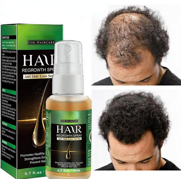 Hair Growth Essential Oil | Fast Hair Growth Serum Spray - $9.80+