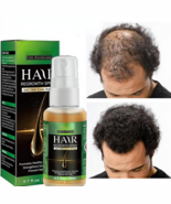 Hair Growth Essential Oil | Fast Hair Growth Serum Spray - $182.24 MXN+