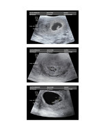 FakeaBaby Prank Fake Ultrasound 4-6 Week Fake Sonogram Emailed Today!  - $9.99