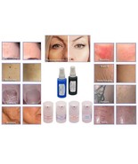 Paquete de muestra de gel y spray de tratamiento 4 máquinas láser y de d... - $99.95