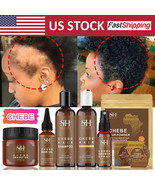 Fast Hair Growth Set Traction Alopecia Chebe Hair Mask Anti Hair Break H... - €14,38 EUR+