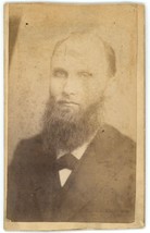 Circa 1880&#39;S Haunting Antique Cdv Of Creepy Man With Sunken Eyes And Beard - £9.58 GBP