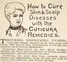 1887 Cuticura Victorian Quack Medicine Potter Boston Advertisement 3x2.5 - £9.04 GBP