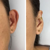 Big ears corrector - $53.00