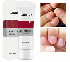 Lanbena Fungal Nail Treatment Onychomycosis Remove Nail Repair Gel Serum 20g - £8.64 GBP