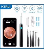 NEW LED Ear Wax Cleaner Ear Camera Otoscope with Light Cleaner Removal Kit - $23.23 CAD