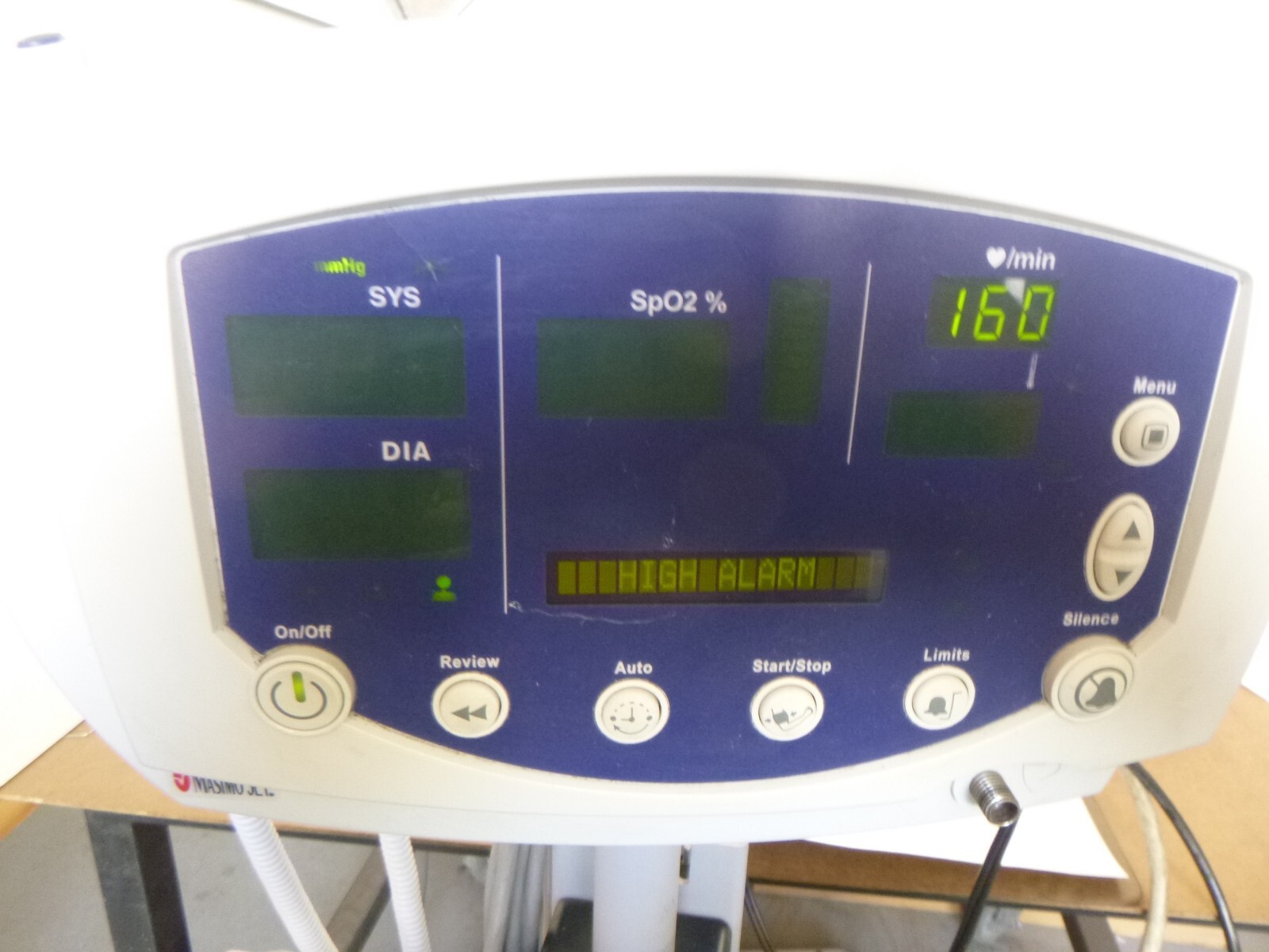 Welch Allyn 300 Series Vital Signs Monitor w/Rolling Stand, Basket, Powe... - $289.06
