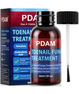 Toenail Fungus Treatment Extra Strength Toe Nail Fungus Treatments for T... - $32.17