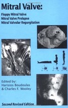 Mitral Valve: Floppy Mitral Valve, Mitral Valve Prolapse, Mitral Valvula... - £27.28 GBP