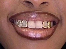 Custom Fit 14K Gold Plated Mouth Teeth Double Open Face Iced Grillz Cap 2Pc Set - $19.79