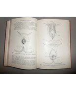 1945 Gynecology and Gynecologic Nursing Hardcover by Miller &amp; Bryant Tex... - $89.05