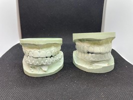 Lot of 2 Sets Vintage Dental Teeth Impression Molds Plaster Matching Upp... - £26.43 GBP